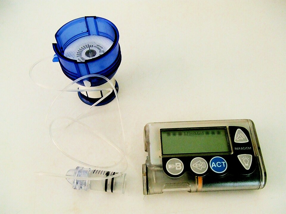 FDA Names Dexcom First Participant in TEMPO, Its Outcome-Lin